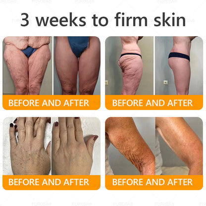 Limited to 10 jars! 🌟PUROSA®—Exclusive 30% discount, restore your skin's youthful glow in just 1-3 weeks! A rare opportunity — won’t be available again until next year, don’t miss out!180-day money-back guarantee, full refund with no risk!