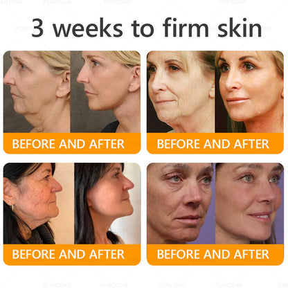 PUROSA® Bee Venom Skin Repair Cream(Visible results in 7 days✅Anti-Aging·Firming·Deep Hydration·Damage Repair·Even Tone·Acne&Dark Spot Care·Wart & Mole Reduction·Psoriasis Relief)