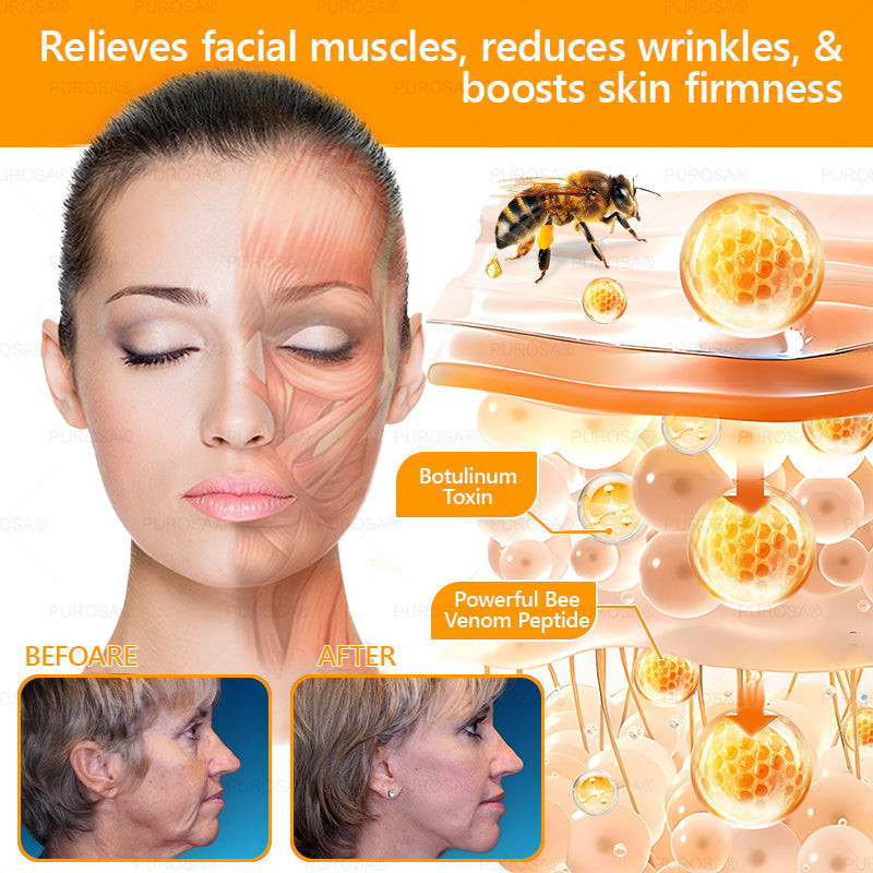 PUROSA® Bee Venom Skin Repair Cream(Visible results in 7 days✅Anti-Aging·Firming·Deep Hydration·Damage Repair·Even Tone·Acne&Dark Spot Care·Wart & Mole Reduction·Psoriasis Relief)