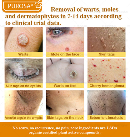 PUROSA® Bee Venom Skin Repair Cream(Visible results in 7 days✅Anti-Aging·Firming·Deep Hydration·Damage Repair·Even Tone·Acne&Dark Spot Care·Wart & Mole Reduction·Psoriasis Relief)